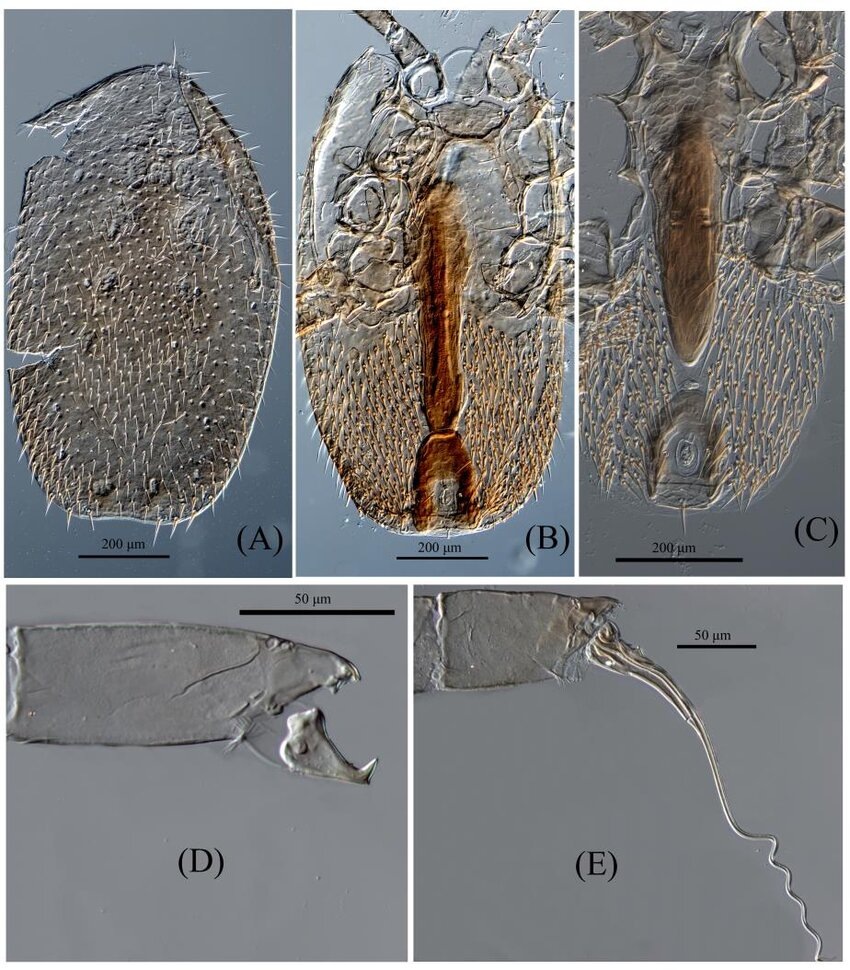 Микрофотографии DIC Tropilaelaps mercedesae — A. Самка, вид сверху, B. Самка, вид снизу, C. Самец, вид снизу, D. Самка, хелицеры, E. Самец, хелицеры/ фото О.Джохарчи, В. Столбова