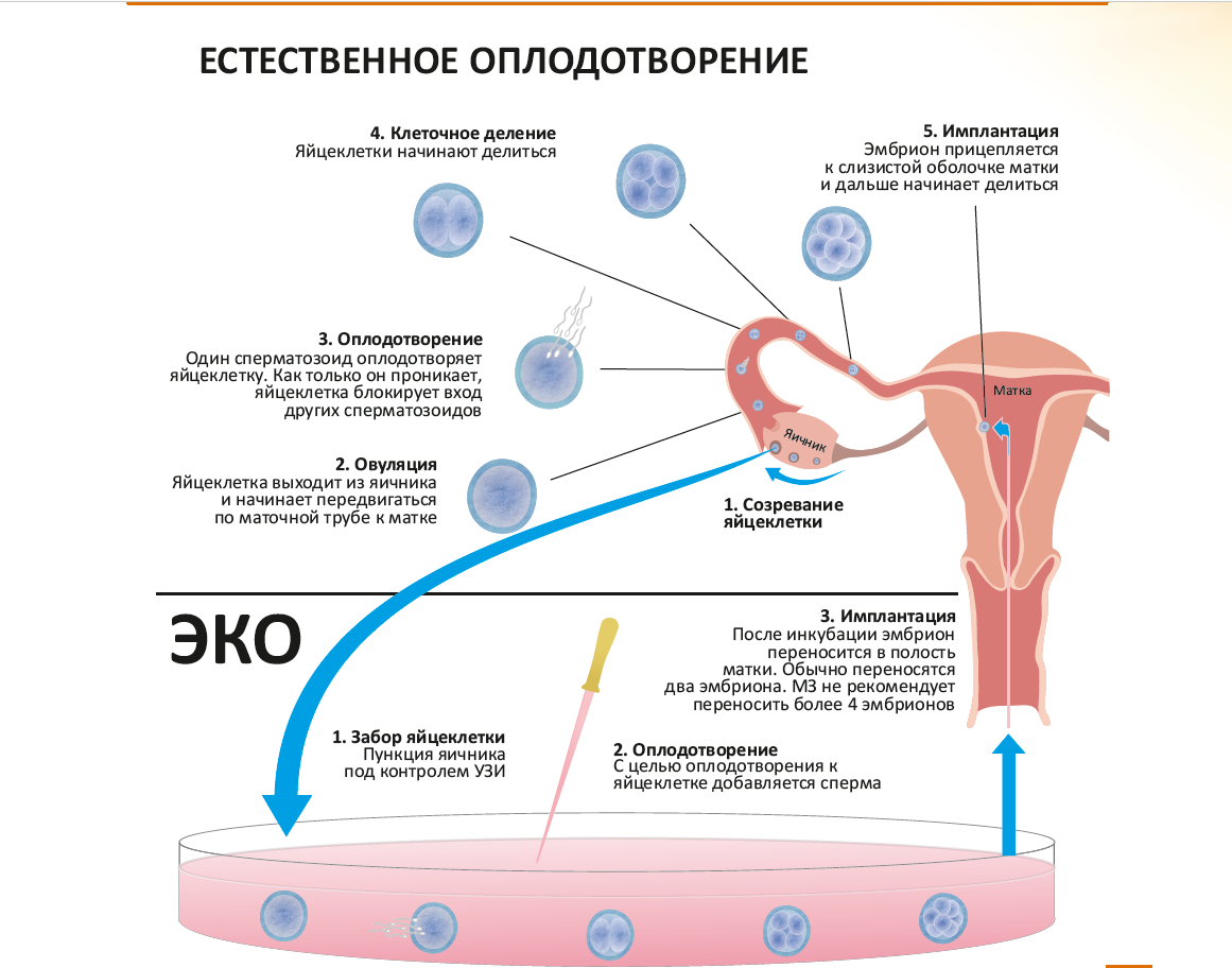 Более 10 миллионов детей по всему миру родились благодаря ЭКО с тех пор, как 25 июля 1978 года на свет появилась Луиза Браун. Браун была первым человеком, зачатого с помощью этой технологии после более чем десятилетних исследований.