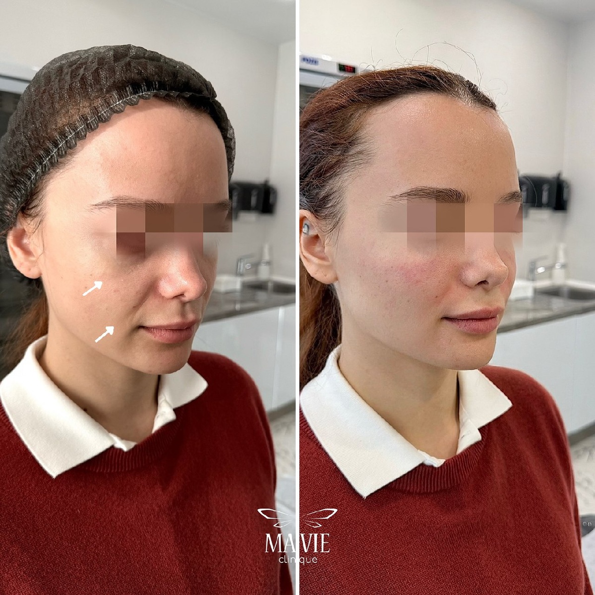 На фото- работа доктора Миланы Дадаевны💙