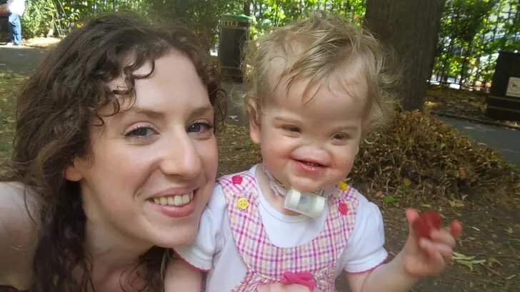 Девочка родилась с редким заболеванием