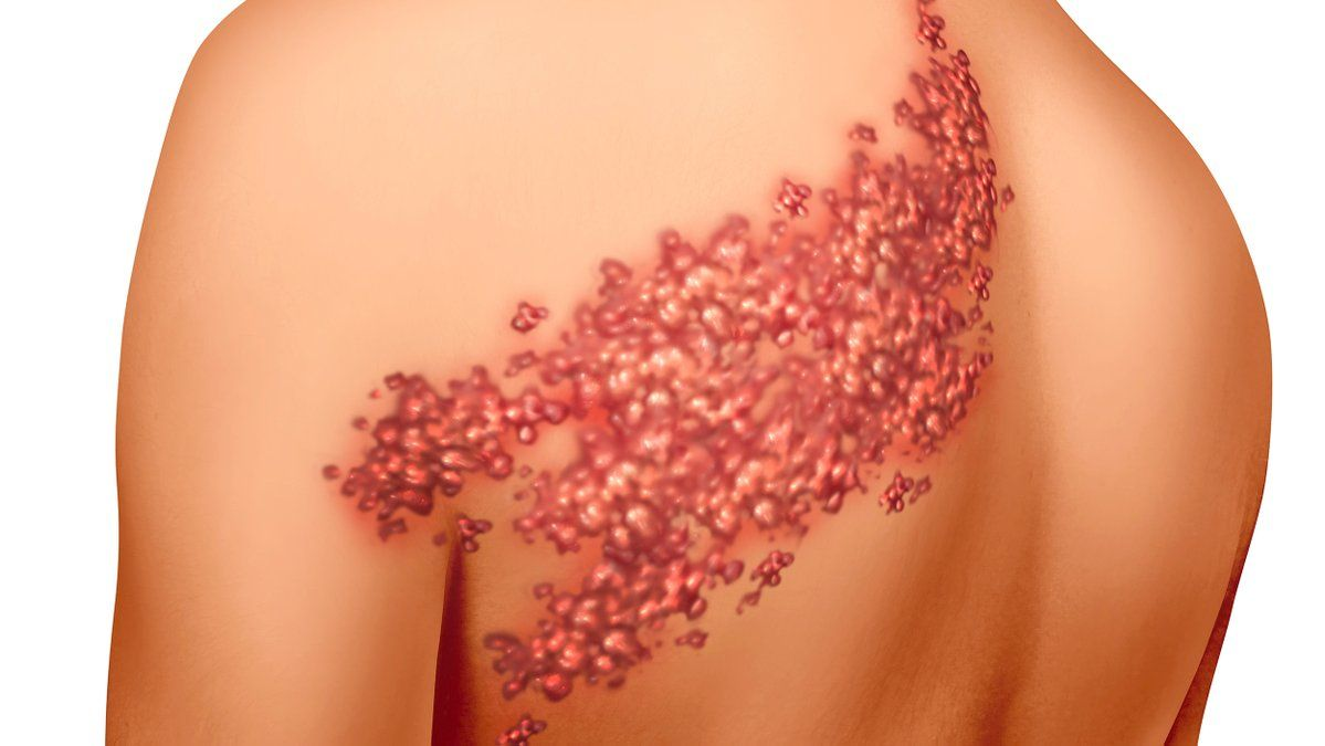 Пример того,что может быть при покупке не качественной бытовой химии.