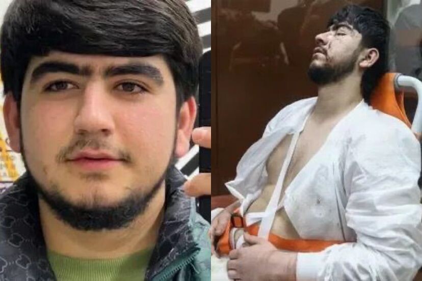   Террорист Файзов*до теракта в Крокус Сити Холле и после задержания в зале суда