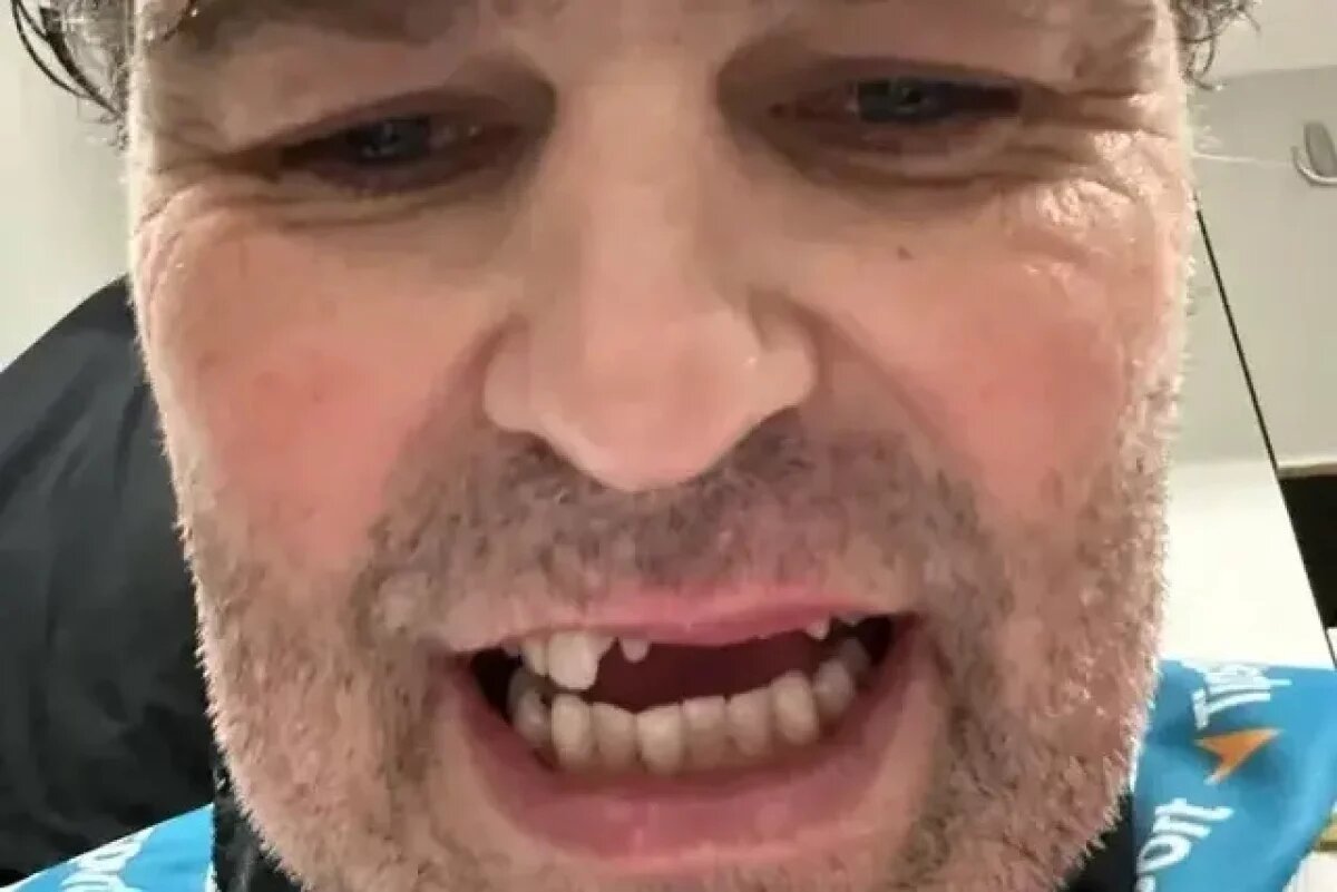    Чешский хоккеист Яромир Ягр показал фото с выбитыми передними зубами