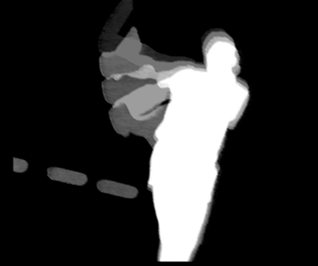 Видеоинсталляция "Ты и теннис" художника Арсения Власова в  XL галерее г. Москва 2004 г. 