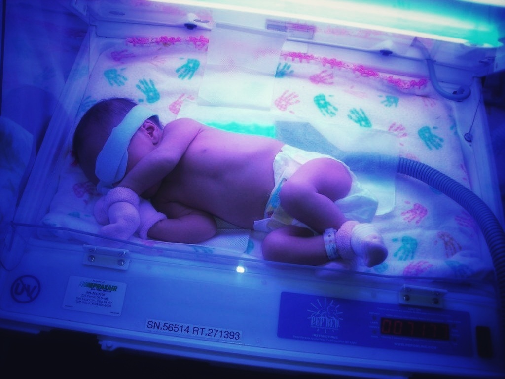 При клинически значимом уровне билирубина применяют фототерапию (напишу отдельно)