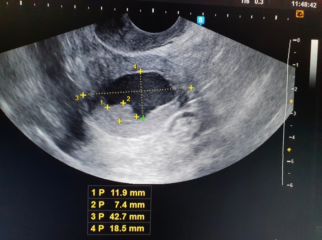 Фото из личного архива.  Поперечный срез. 