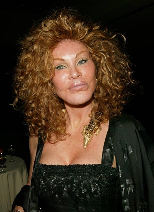 Джоселин Вильденштейн.