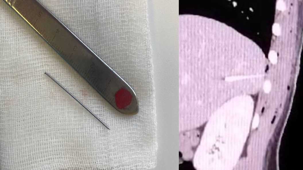    фото: коллаж фото Телеграм-канала ДРКБ