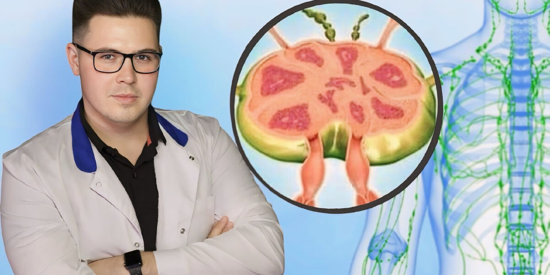 Как запустить лимфатическую систему, очистить организм и похудеть: 5 действенных советов и 5 признаков застоя