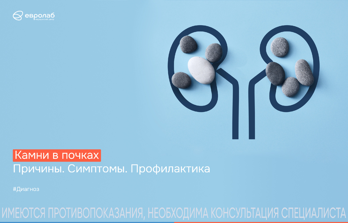 камни в почках