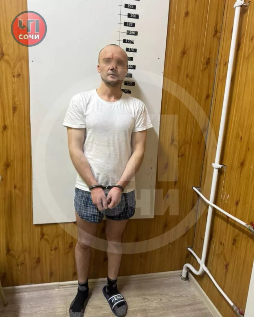 На лице заметны царапины и ссадины.