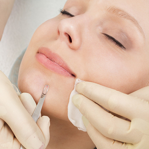 Чистка лица. Источник: https://nadialan.kz/kosmetologiya/chistka-lica