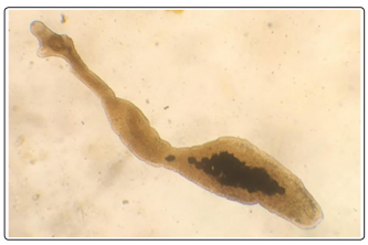 Alveococcus multilocularis
