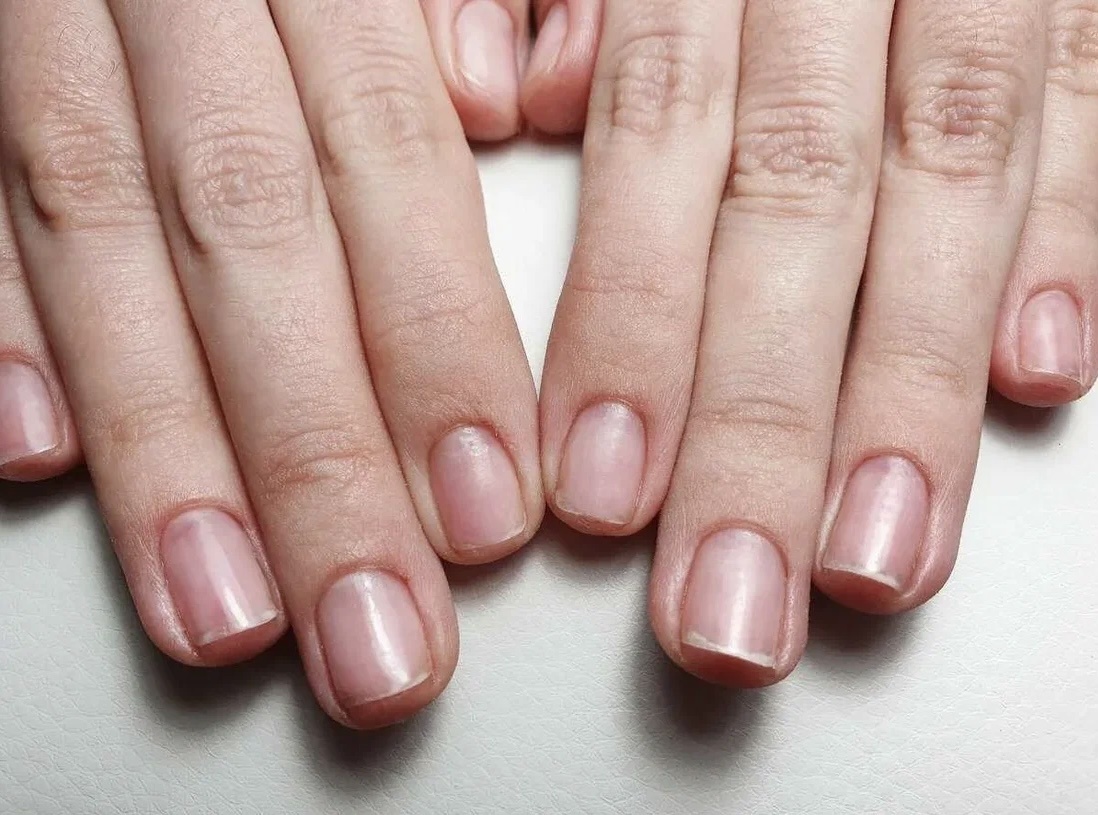 Есть заметные красные пятна возле основания ногтей.