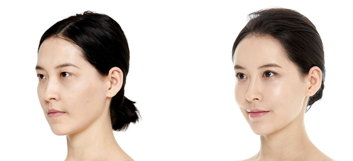 Операция двойного века