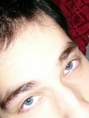 Структура бровей в 20 лет. Видна проблема с облысением в передней зоне.