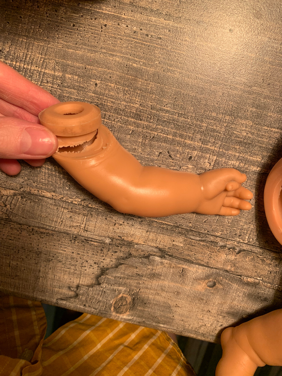 Болявка плечевого сустава :)