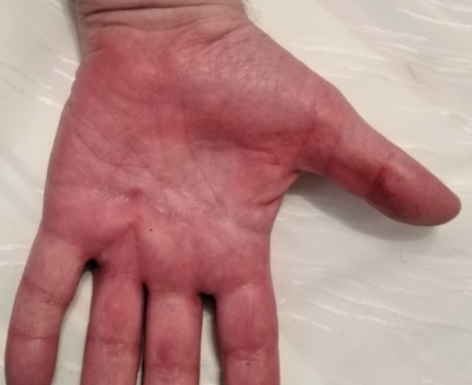 Диагноз по внешним признакам