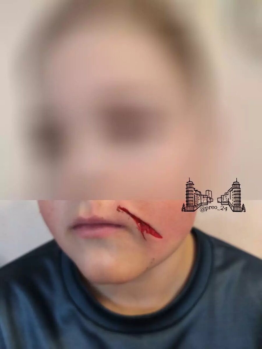     Источник: «Преображенский Красноярск», t.me