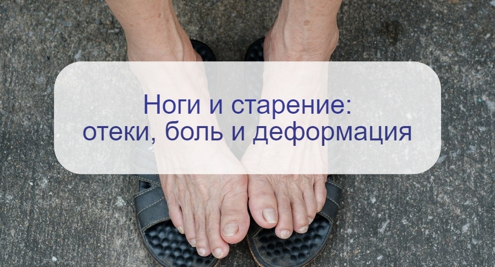 Возрастные проблемы с ногами – не только боль в суставах, но и отеки, шпоры и деформации пальцев