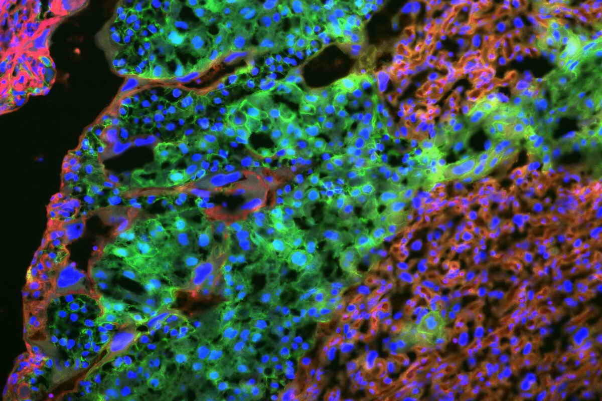 Гены отца | Контроль питания плода