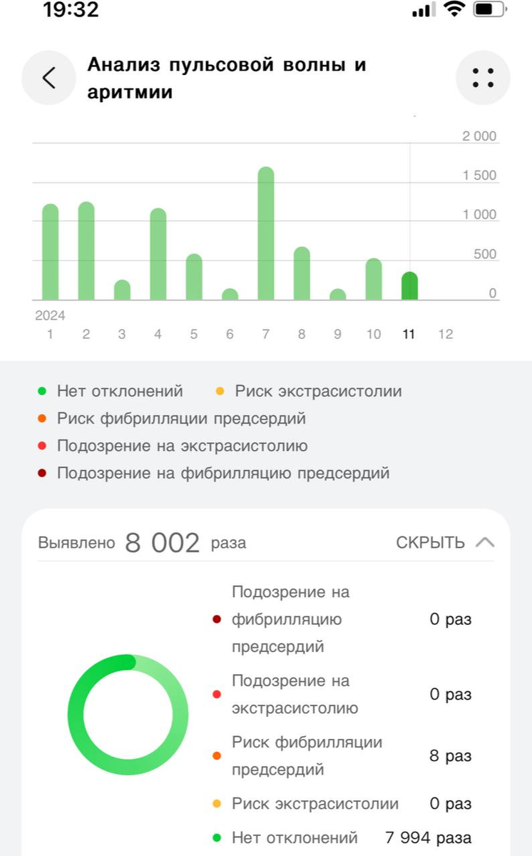 анализ аритмии / Валерия Изюмова Другая Кухня