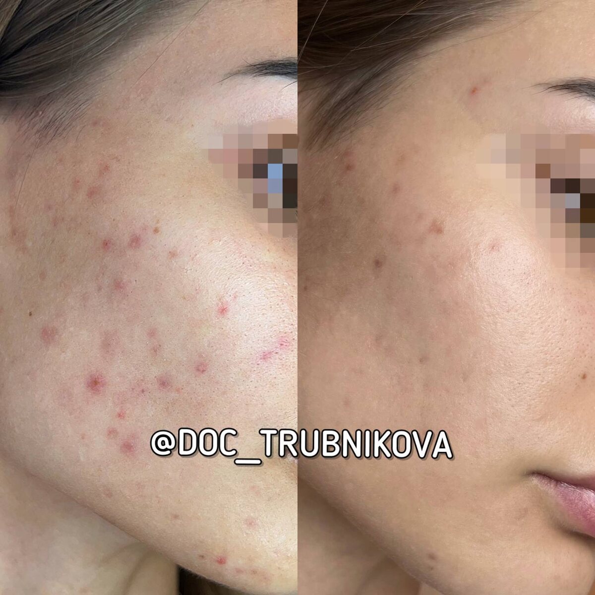 Шикарная кожа в награду за терпение и соблюдение рекомендаций