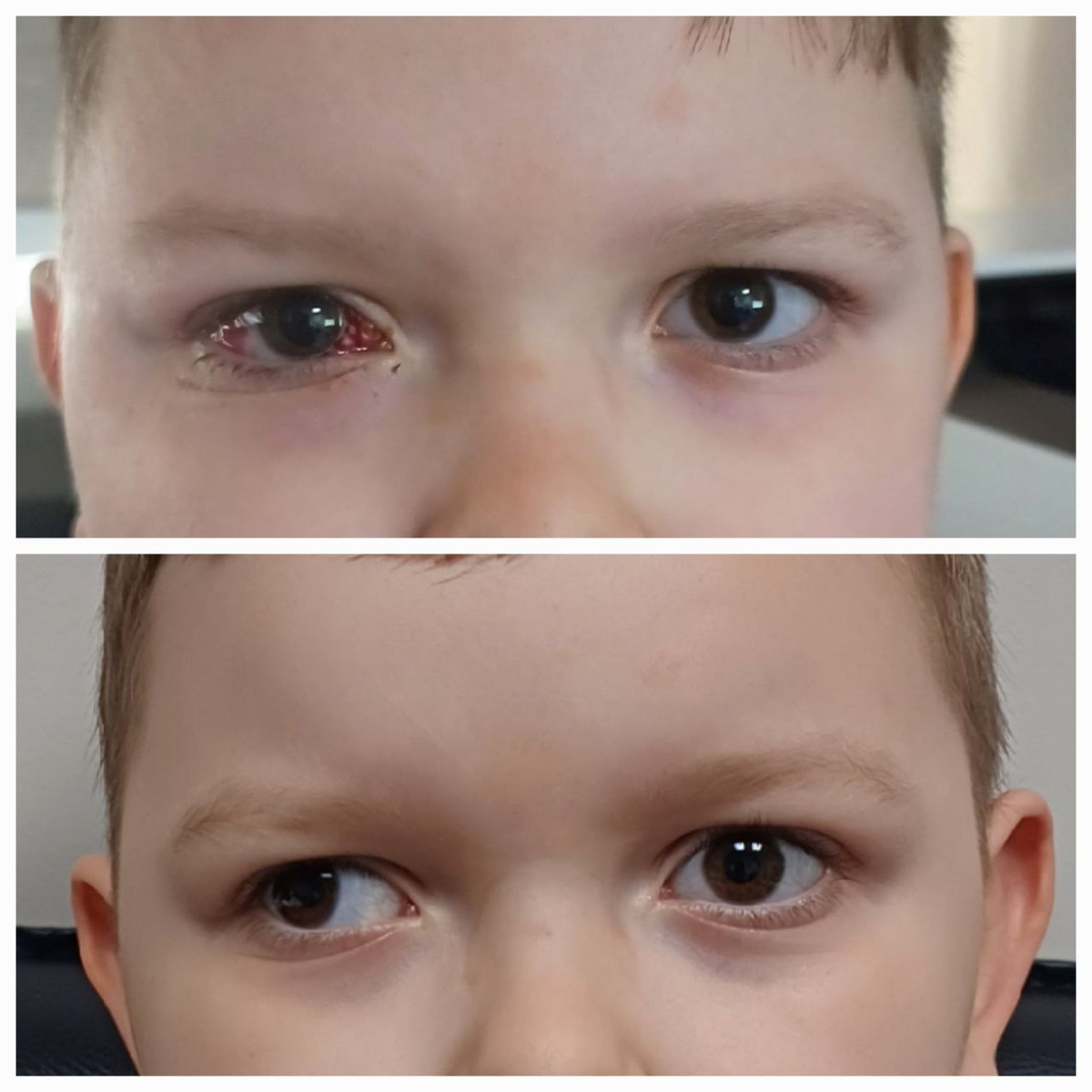 Ребенок до операции и после операции