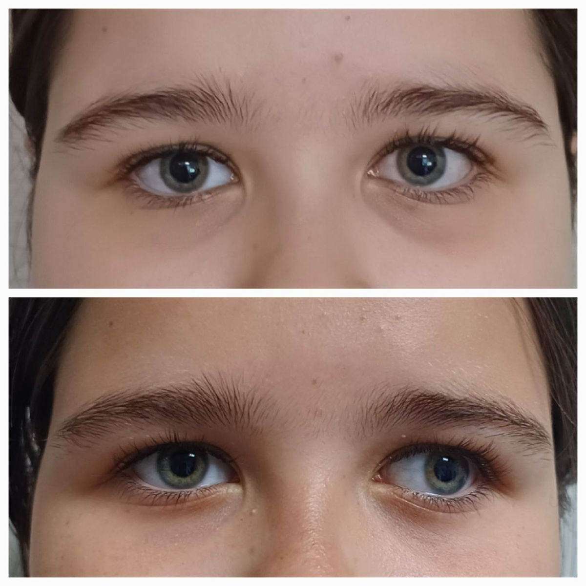 Ребенок до операции и после операции