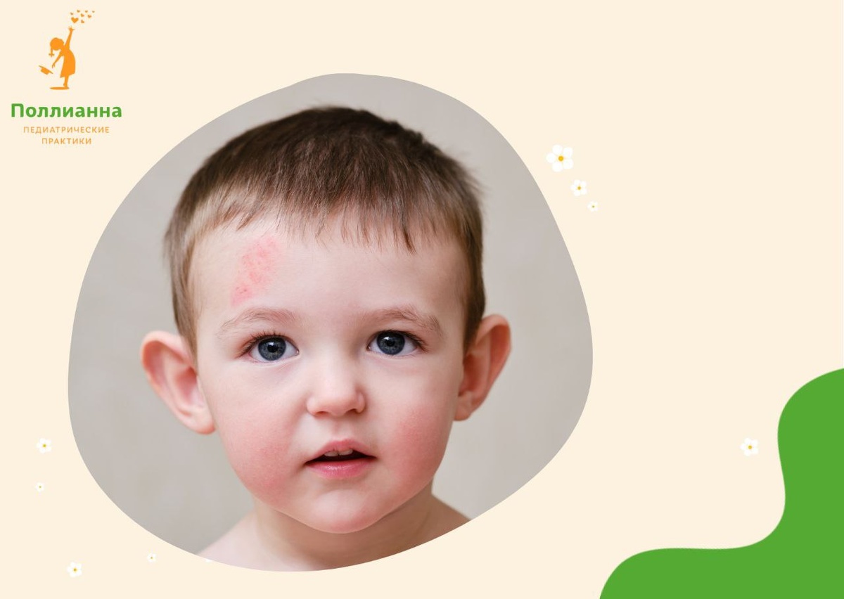 Поллианна педиатрическая практика. Фото из открытых источников.