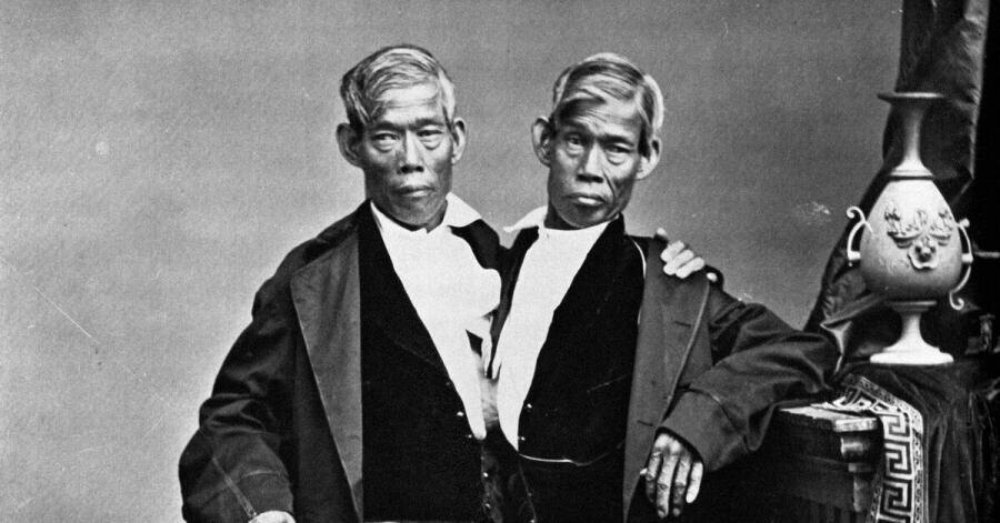    Драматическая история сиамских близнецов Чанга и Энга: как закончился их жизненный путь? Фото: общественное достояние