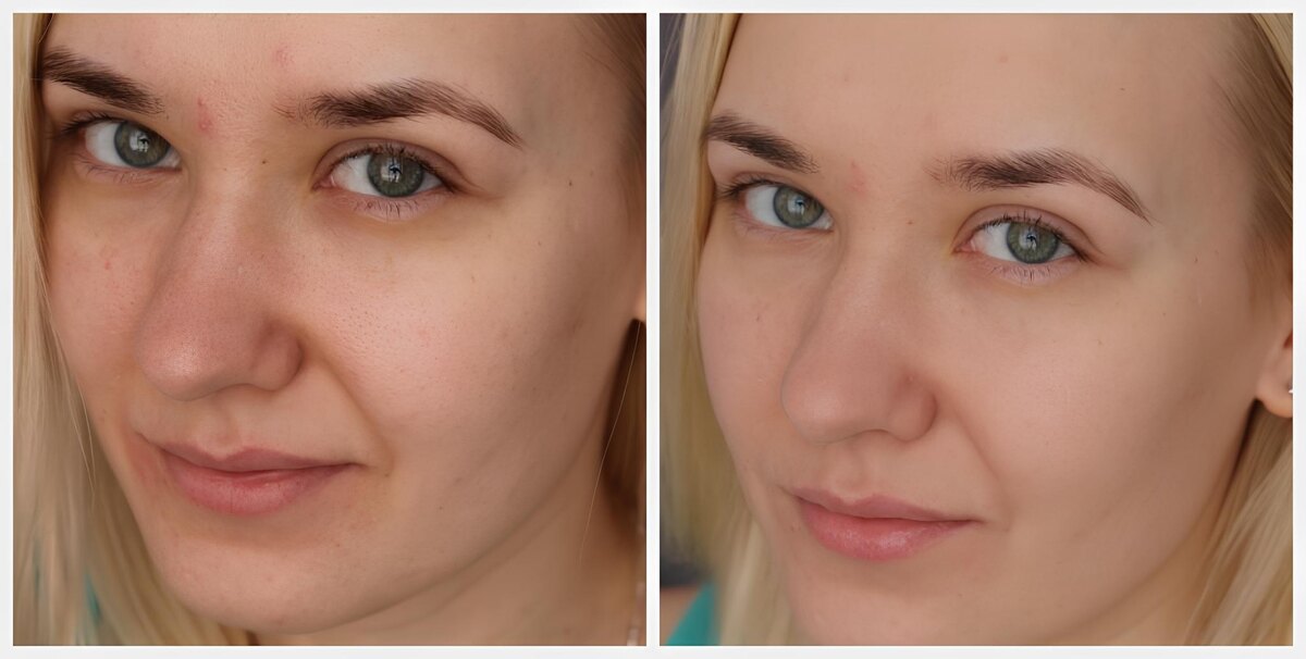 Гиалурон крем: что делает его незаменимым для всех типов кожи