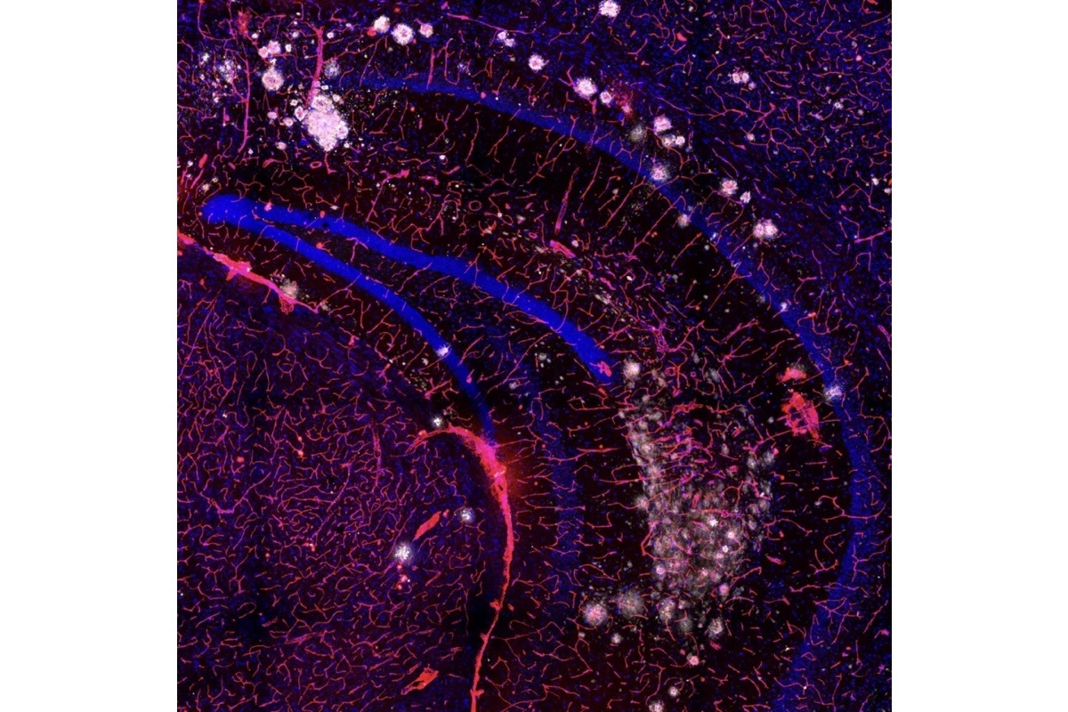 Ka Ka Ting / Centenary Institute📷Снимок под названием «Затуманенный мозг с вероятностью забывчивости» запечатлел гиппокамп мыши — область мозга, отвечающую за память, обучение и эмоции