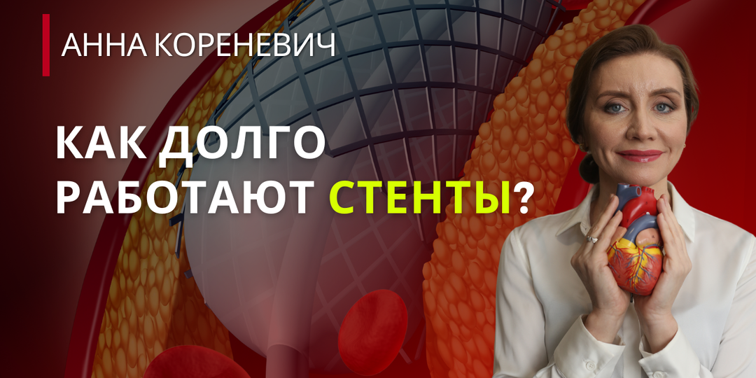 Как долго работают стенты?
