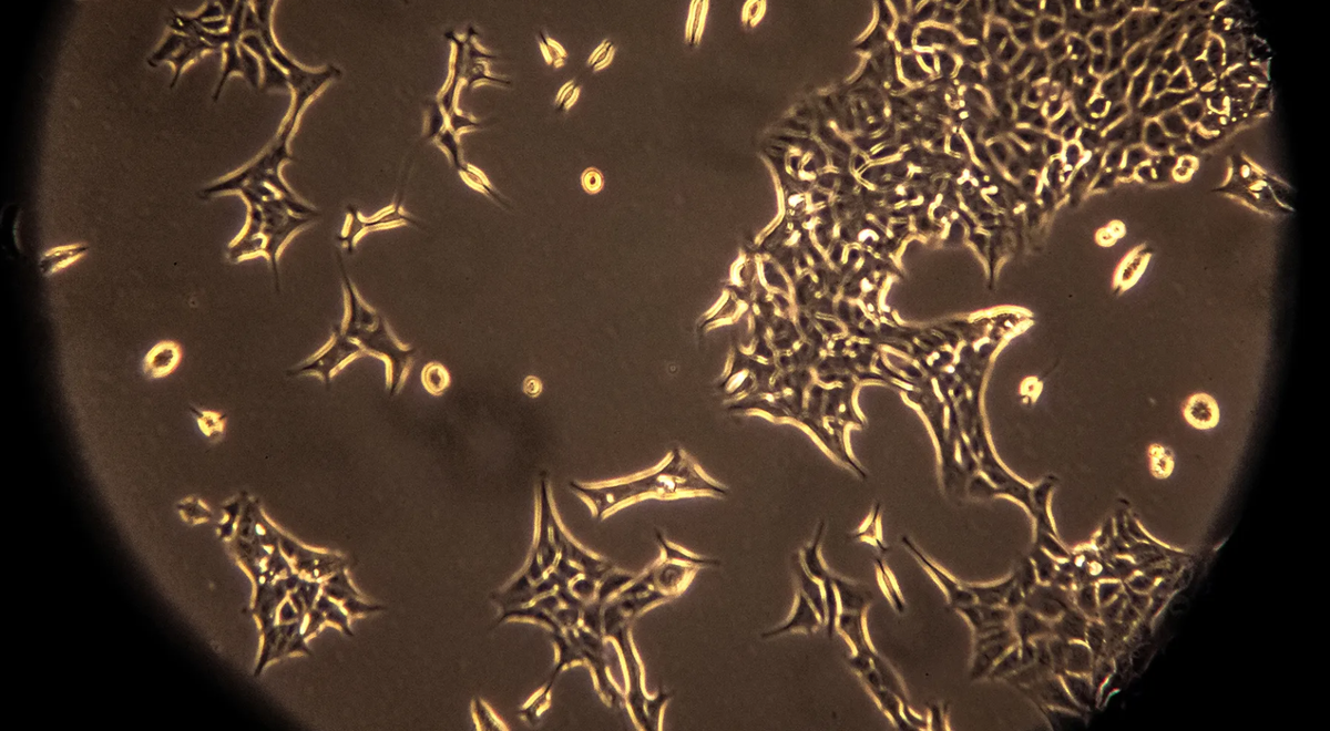 Хотя искусственный интеллект все еще не может заменить реальный опыт врача или даже поставить истинный медицинский диагноз, он может стать важным инструментом для повышения эффективности его работы.