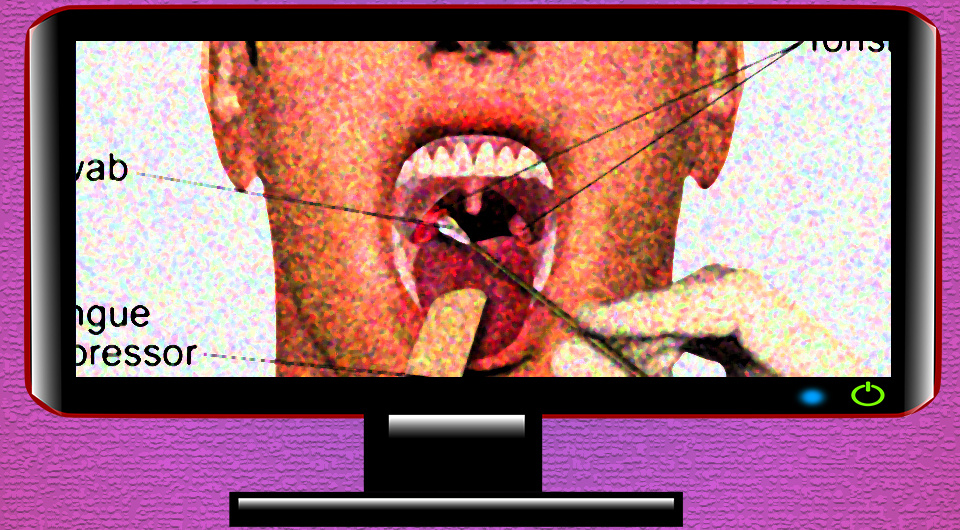   N + 1; OpenClipart / Wikimedia Commons / Public Domain; BruceBlaus / Wikimedia Commons / CC BY-SA 4.0