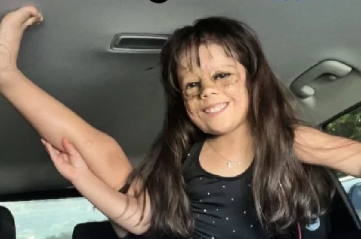    Девочке «с маской Бэтмена» отказали в пожертвовании из-за санкций