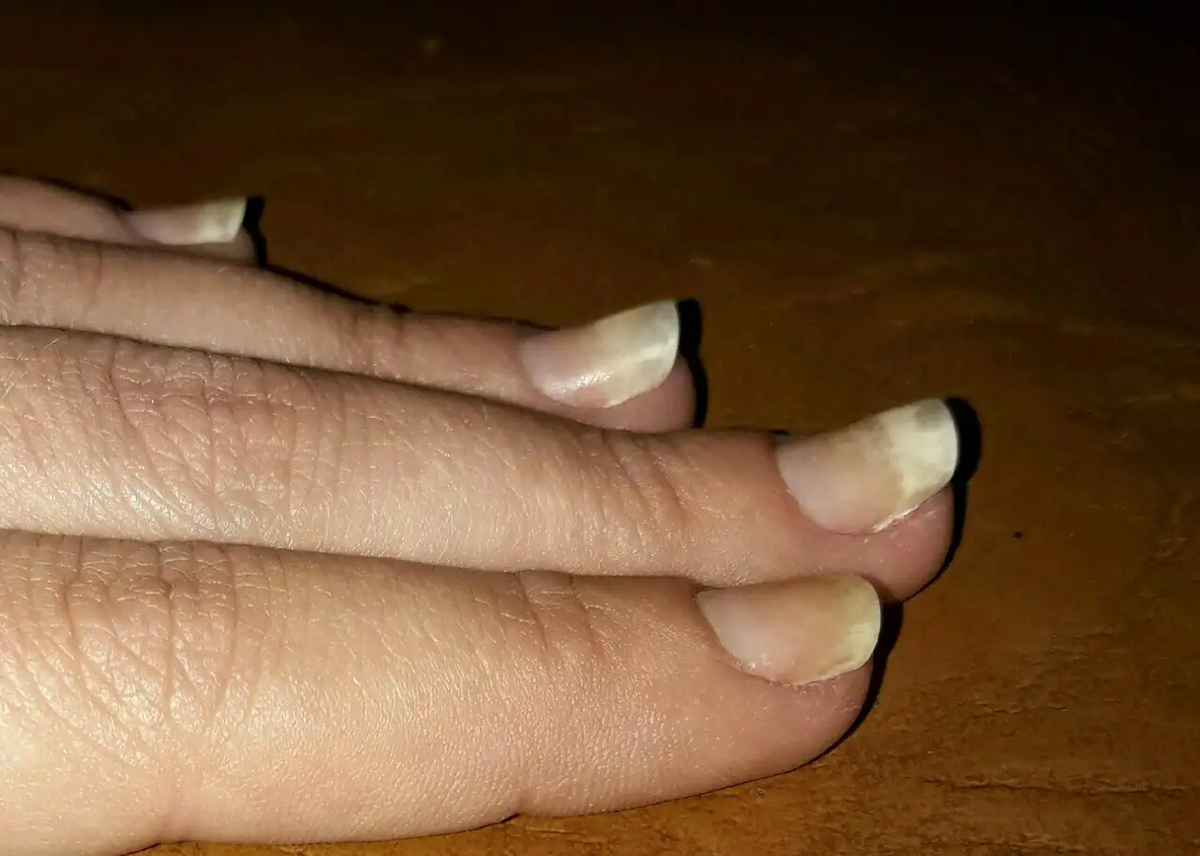 Ногти загнуты вверх. max4u.ru