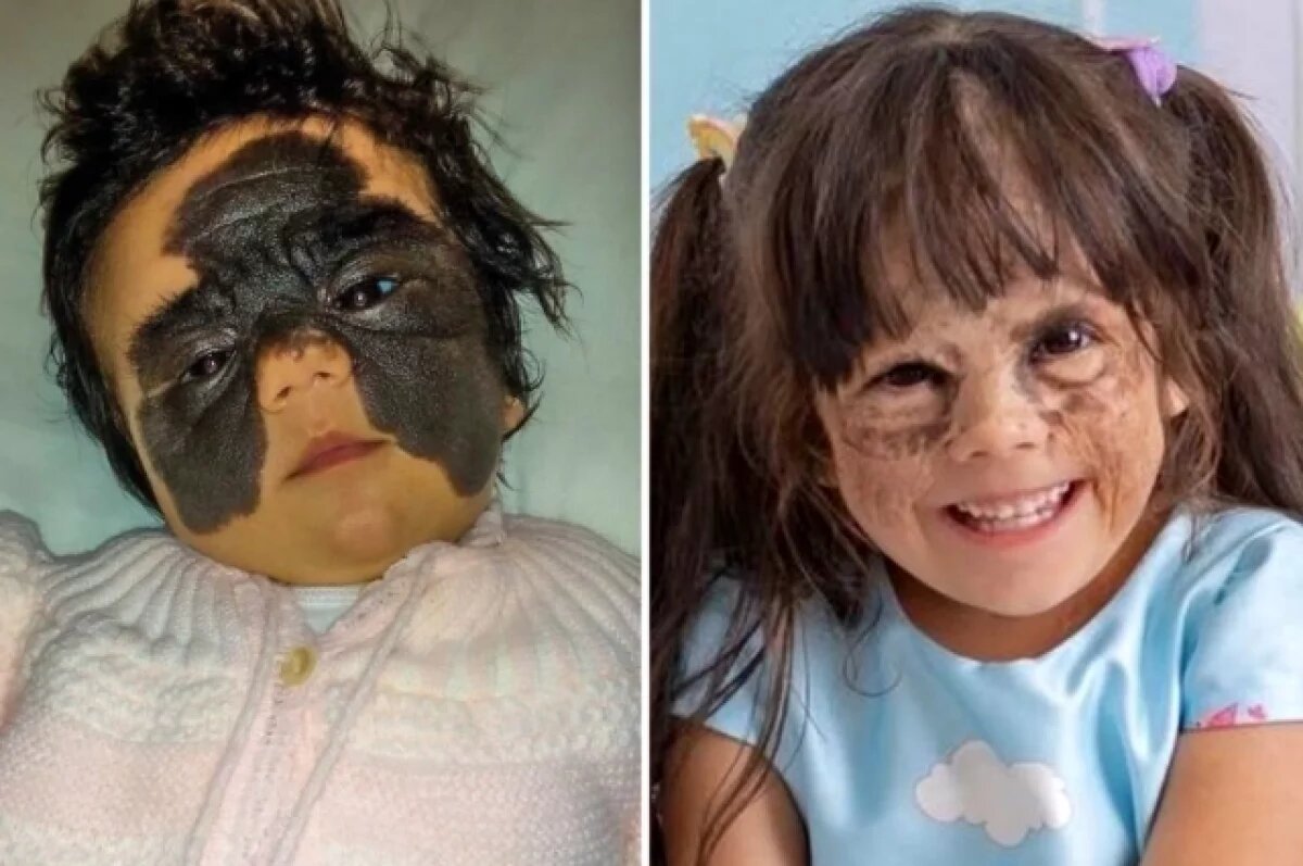    Мама девочки «с маской Бэтмена» рассказала о возвращении в Россию в мае