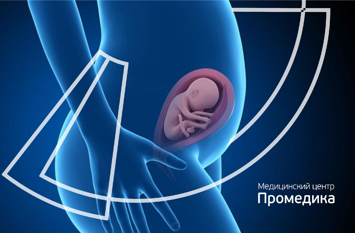 Эндометриоз и беременность: риски, возможности успешного зачатия и особенности беременности.