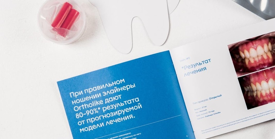 Элайнеры это игрушка или серьезное ортодонтическое лечение?