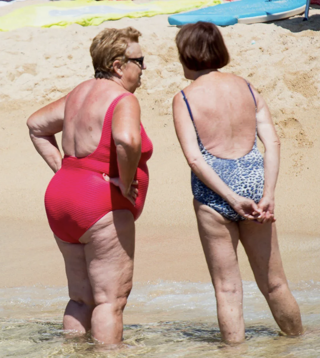 У обеих женщин из сети минимальная мышечная ткань и выраженная в процентном соотношении жировая и соединительная.