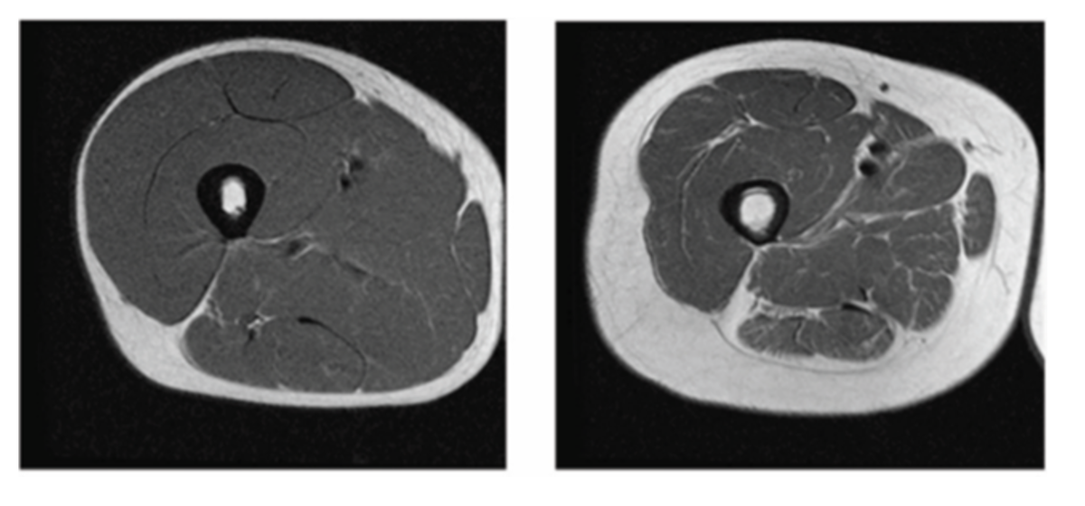Слева здоровый человек, справа уже нет