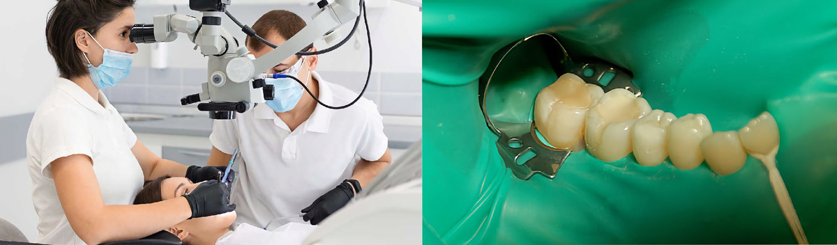 Дентальный микроскоп и коффердам