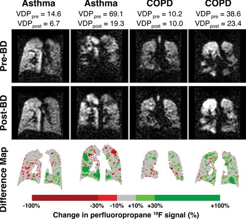 Анализ изменения интенсивности сигнала перфторпропана фтора