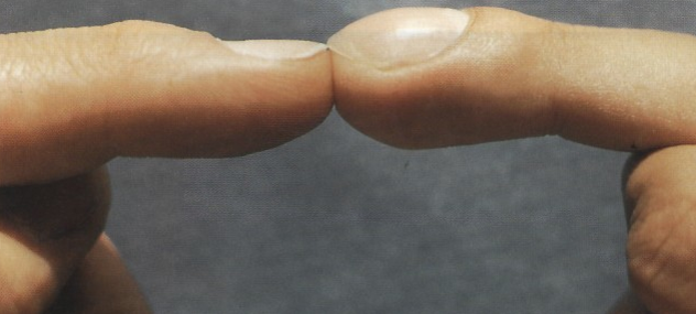 нормальный палец и палец с утощение в крайней фаланге (в виде "барабанных палочек")