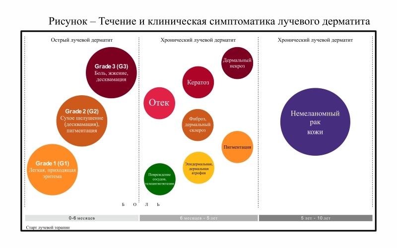 Лучевой дерматит или радиационно-индуцированный дерматит (ЛД/РИД)