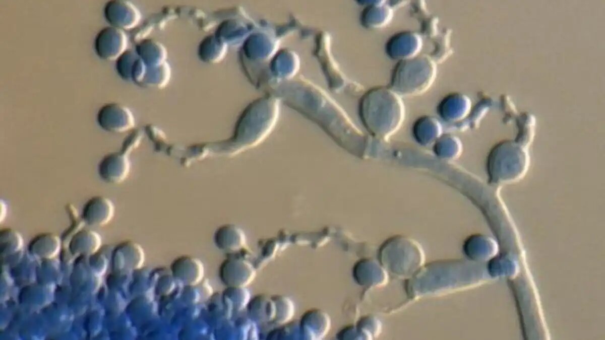 Фото:usda.gov
Beauveria bassiana под микроскопом