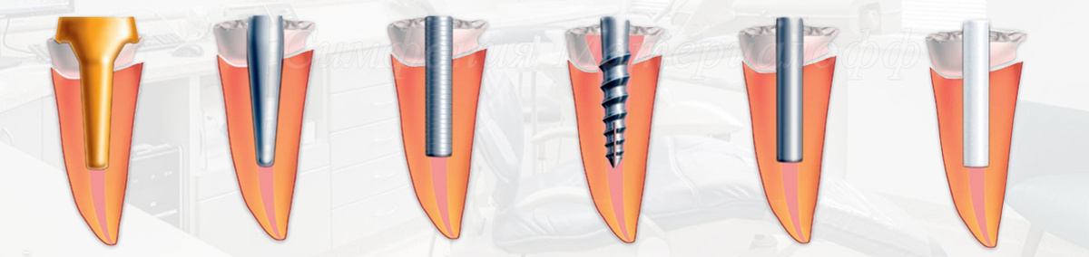 Штифты стоматологические