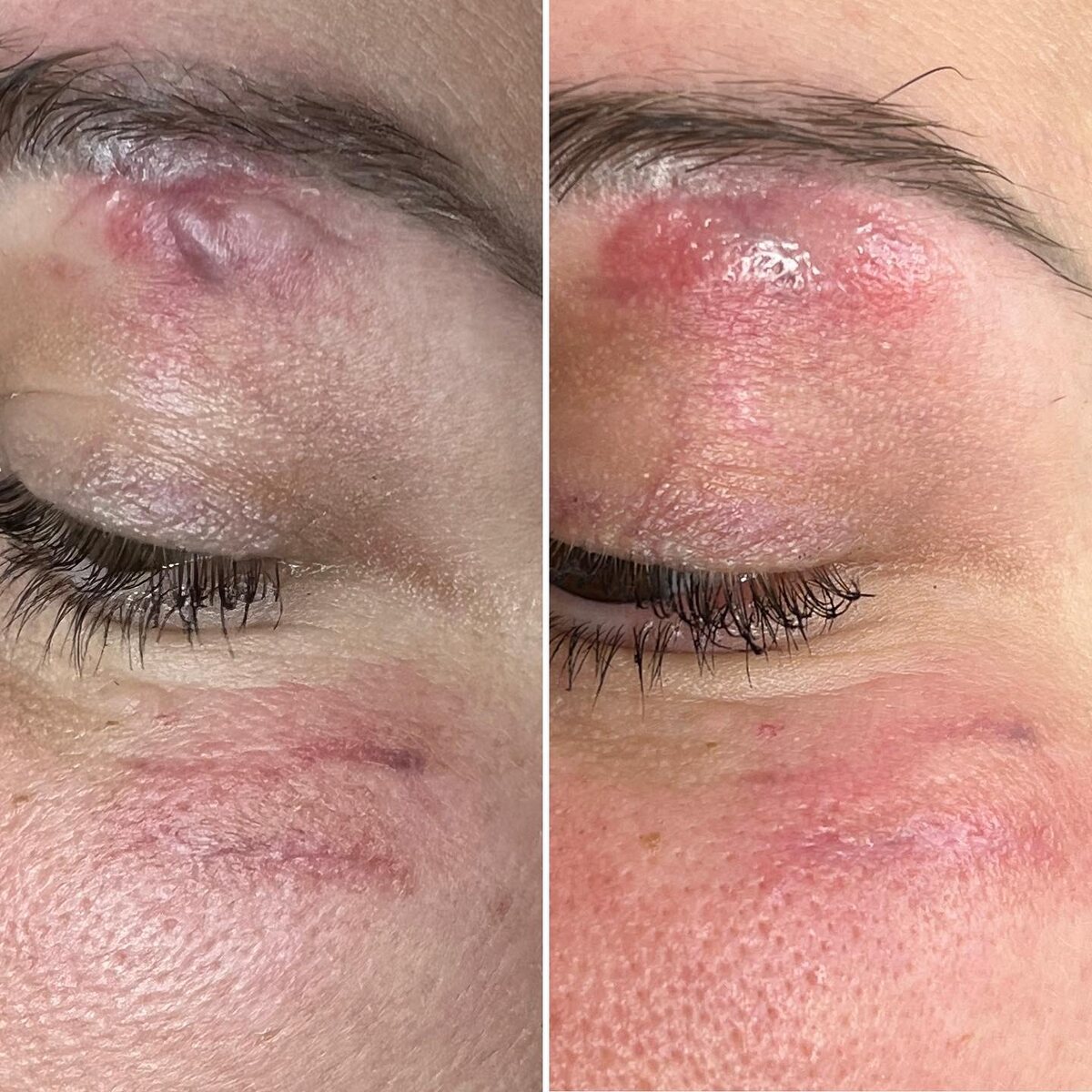 Слева ДО, справа ПОСЛЕ